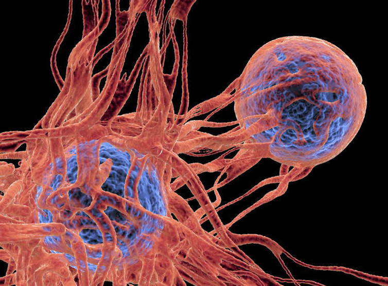 What are the latest advances in cancer research and treatment?